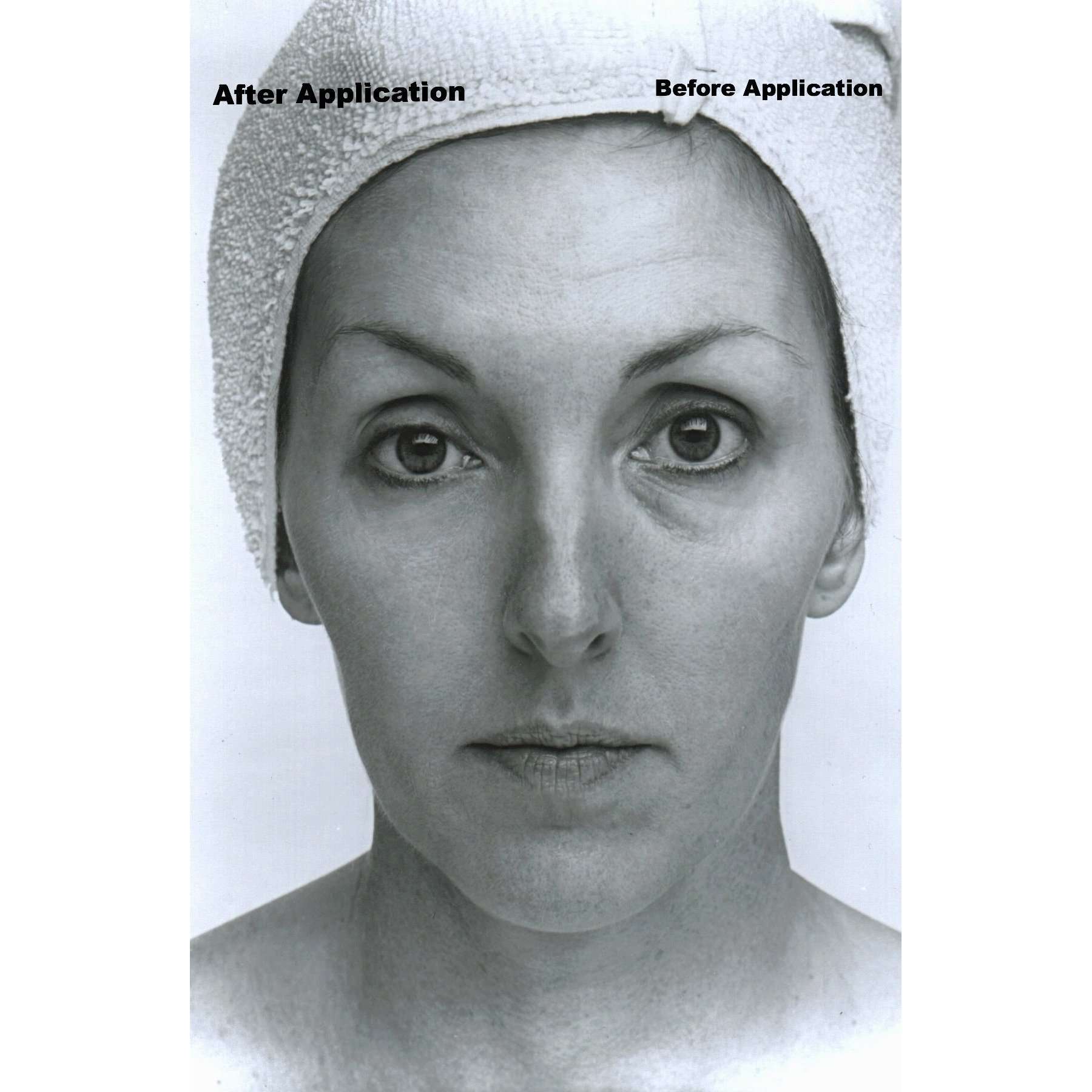 Collagen Lifting Facial with Rapid Wrinkle Erase Cream
