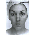 Collagen Face Lift Facial - Single Facial w/Rapid Wrinkle Erase-Travel Sized