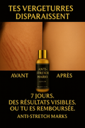 🖤 ANTI-STRETCH MARKS LOTION – Beauty Units
✨ Tes vergetures disparaissent en 7 jours ou tu es remboursée.