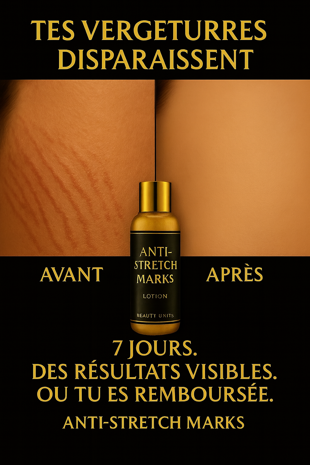 🖤 ANTI-STRETCH MARKS LOTION – Beauty Units
✨ Tes vergetures disparaissent en 7 jours ou tu es remboursée.